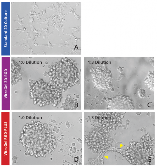 3D Cell Culture of Glioblastoma Cell (U87 MG) in VitroGel® TheWell