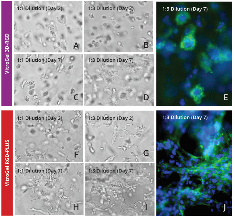 3D Cell Culture of Glioblastoma Cell (U87 MG) in VitroGel® TheWell