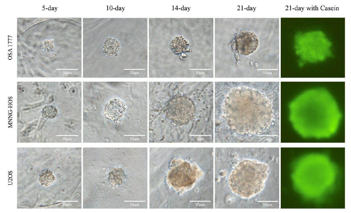 Osa 1777 A New Tool In The Fight Against Bone Cancer Thewell Bioscience