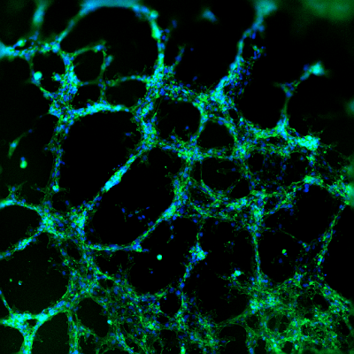 HUVEC tube formation cultured with VitroGel Angiogenesis Assay Kit