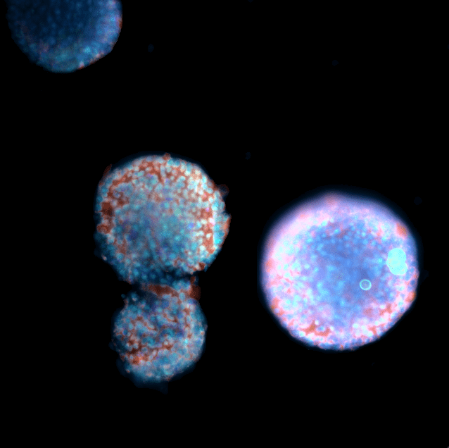 3D stem cells cultured in VitroGel