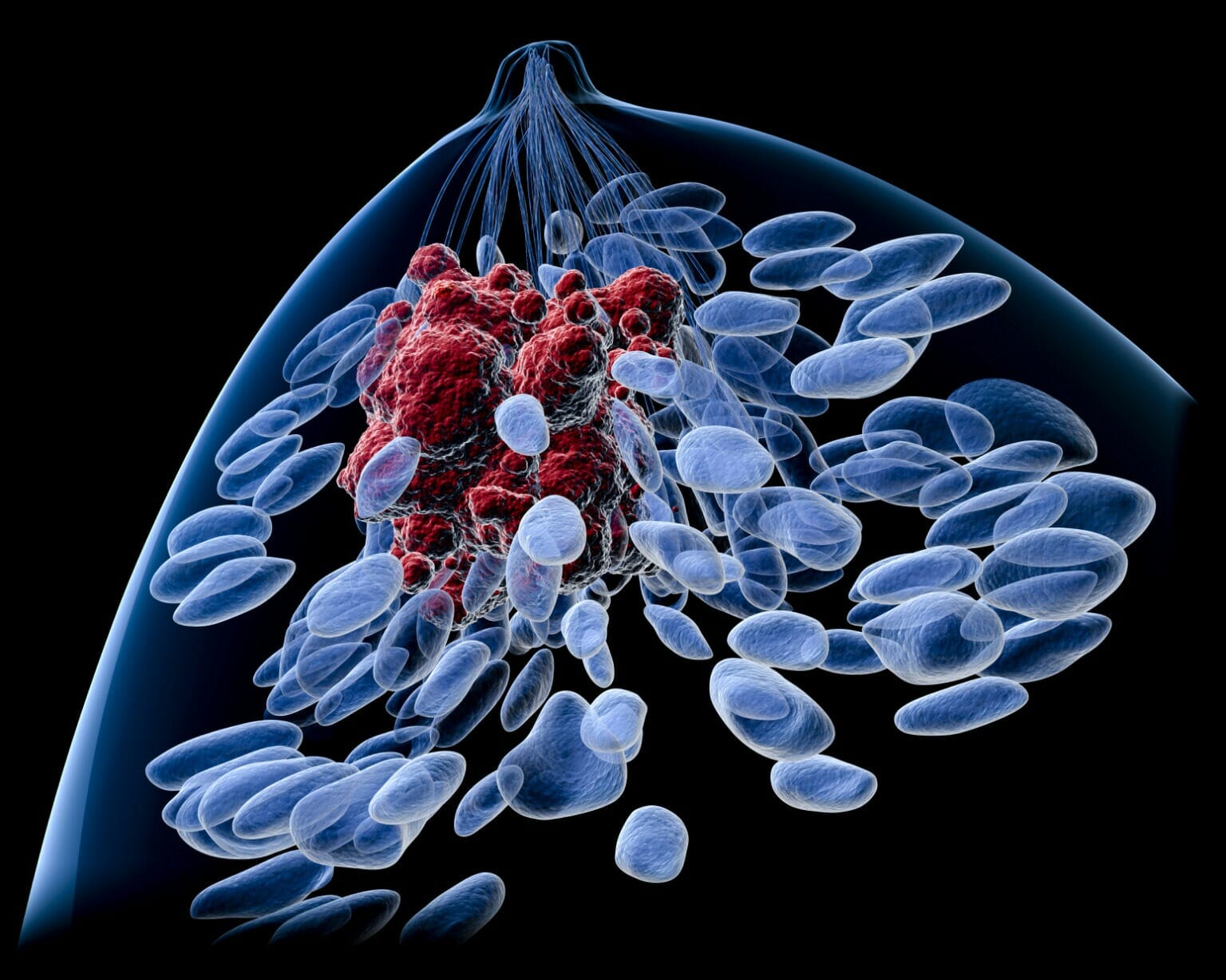 soluble-vimentin-to-suppress-metastatic-breast-cancer-models