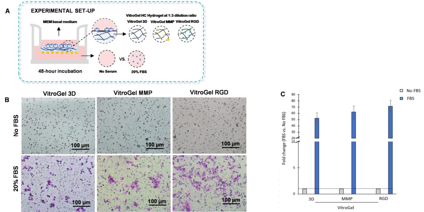 Bio-functional ligands inside hydrogel influence U87-MG glioblastoma cell invasion.