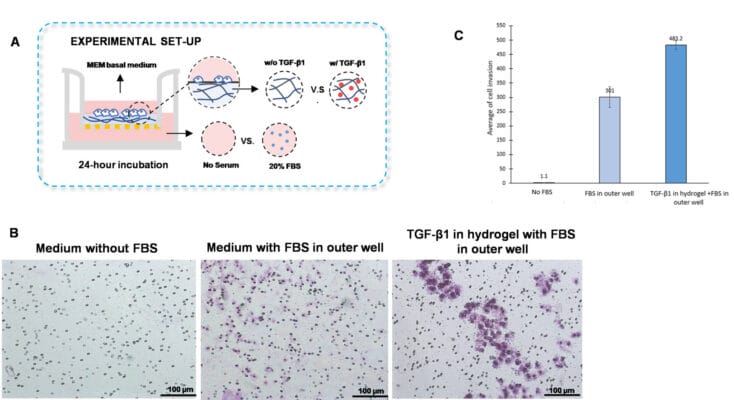 Cell Invasion Assay Kit