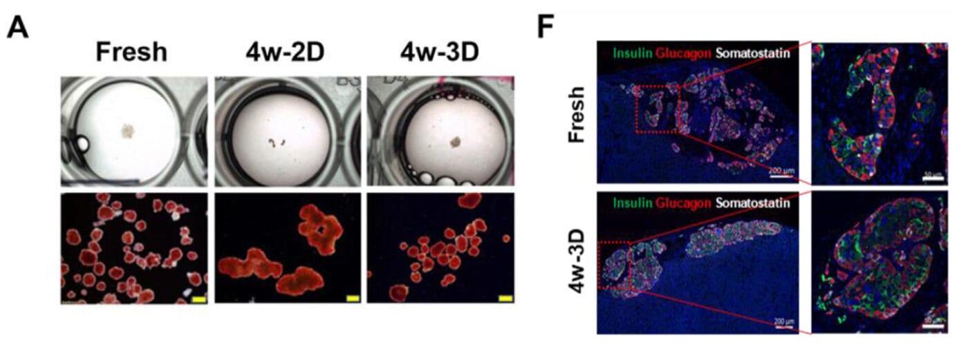 3D-hydrogel long-term cultured human islets showed maintenance of mass, viability, and function.