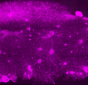 Alternative view of RocketCell™ 3D NSC Complete Growth Kit, AOF