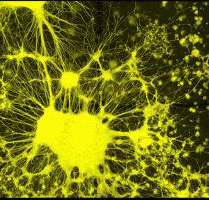 Alternative view of VitroGel® NEURON