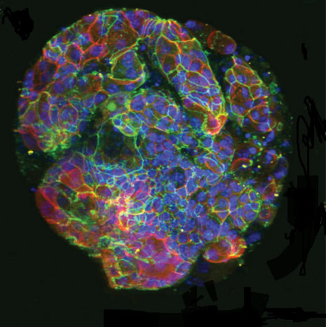 VitroGel-ORGANOID-intestinal-organoids