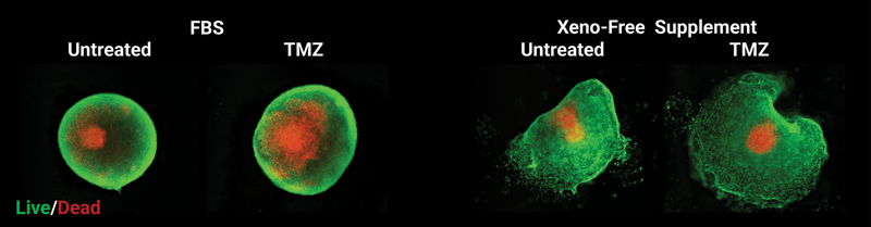 Fluorescent cell images showing Live/Dead viability under four conditions: Untreated, FBS, TMZ, and Xeno-Free Untreated/TMZ. Green = live, red = dead.
