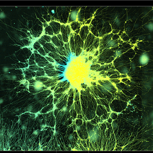 Fluorescent micrograph of a dense neural network with yellow-green neuron projections emanating from a blue central soma cluster under dark background