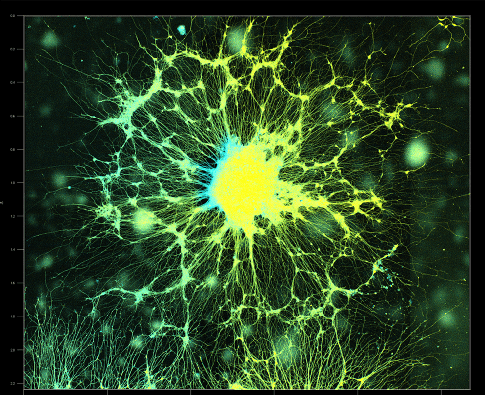 Fluorescent micrograph of a dense neural network with yellow-green neuron projections emanating from a blue central soma cluster under dark background