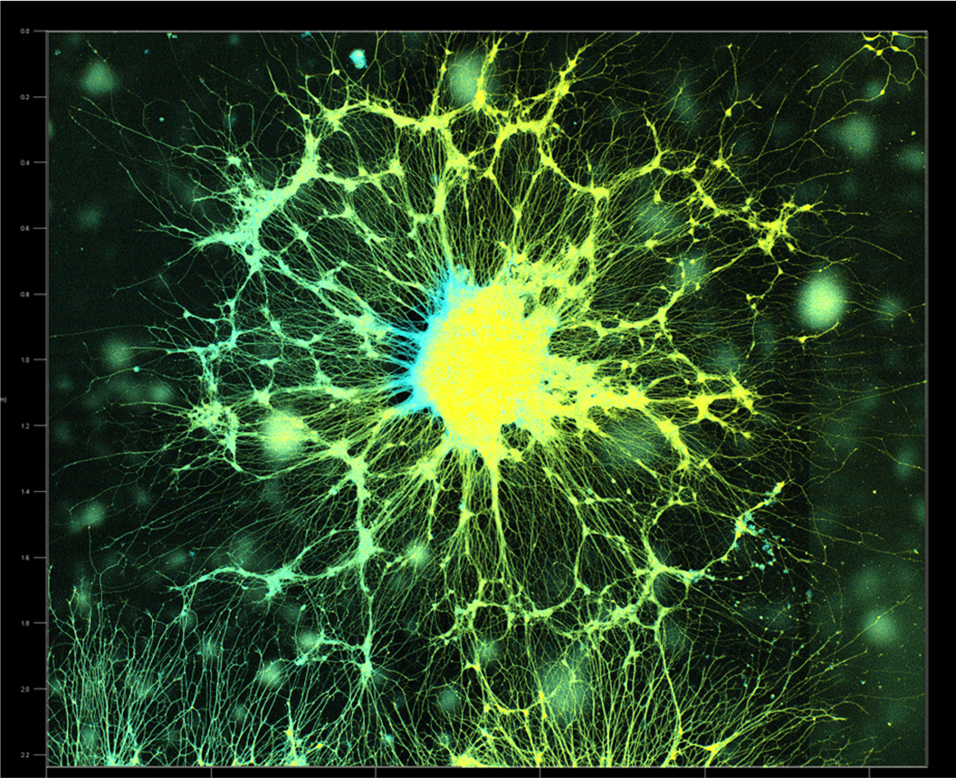 Fluorescent micrograph of a dense neural network with yellow-green neuron projections emanating from a blue central soma cluster under dark background
