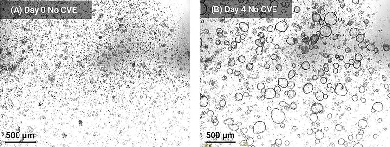 Two side-by-side microscope images labeled (A) Day 0 No CVE and (B) Day 4 No CVE; left shows dense particle clusters, right shows many circular droplets; scale bar 500 μm.
