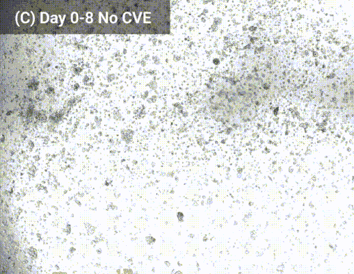 Grayscale micrograph-like image with dense dark speckles scattered over a light background; watermark 'Day 0-8 No CVE' in the top-left corner.
