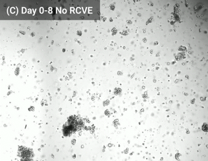 Grayscale micrograph of a field with many small circular particles and a few larger clumps; top-left shows '(C) Day 0-8 No RCVe'.