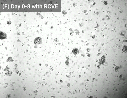 Black-and-white micrograph of a cell culture with numerous round cells scattered across the field; caption in the corner reads '(F) Day 0-8 with RCVE'.