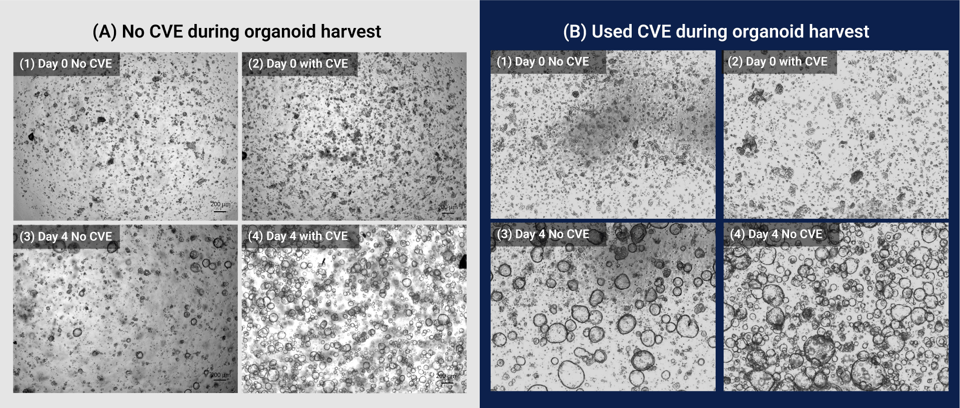 Day 0, No CVE: micrograph of organoid culture with dispersed cells (scale bar 200 µm).