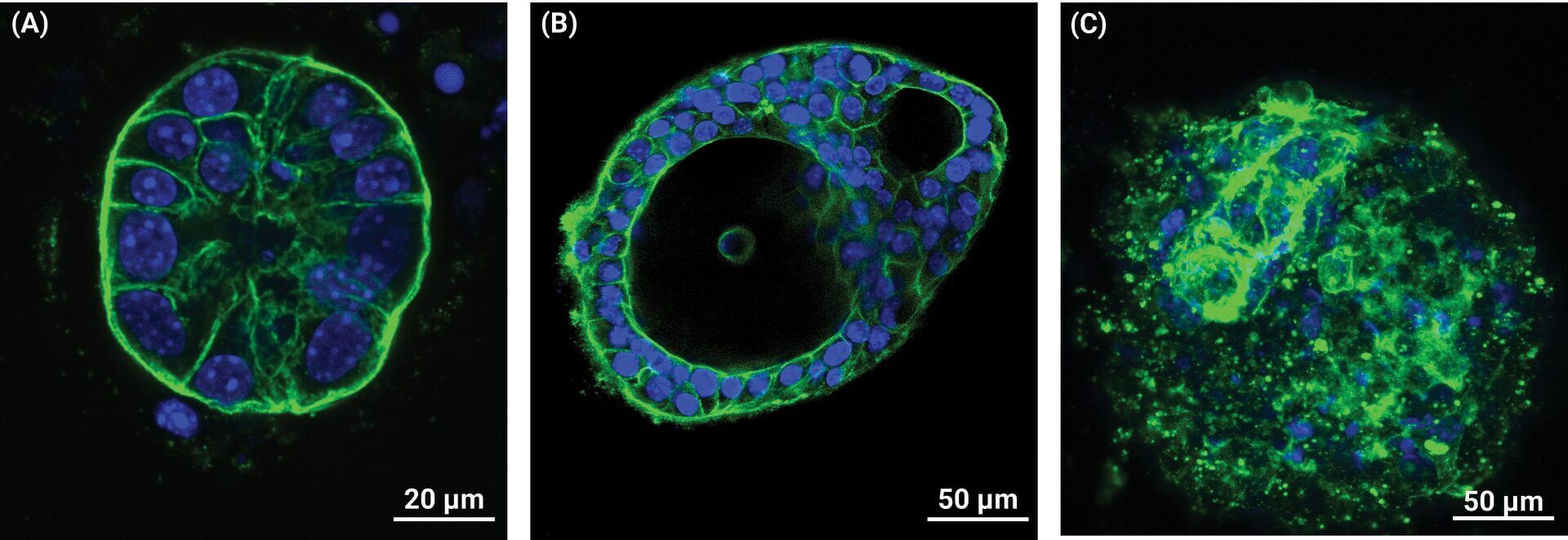 Fluorescence image of a round cell with a green outline and blue nuclei arranged inside the circle. (A)