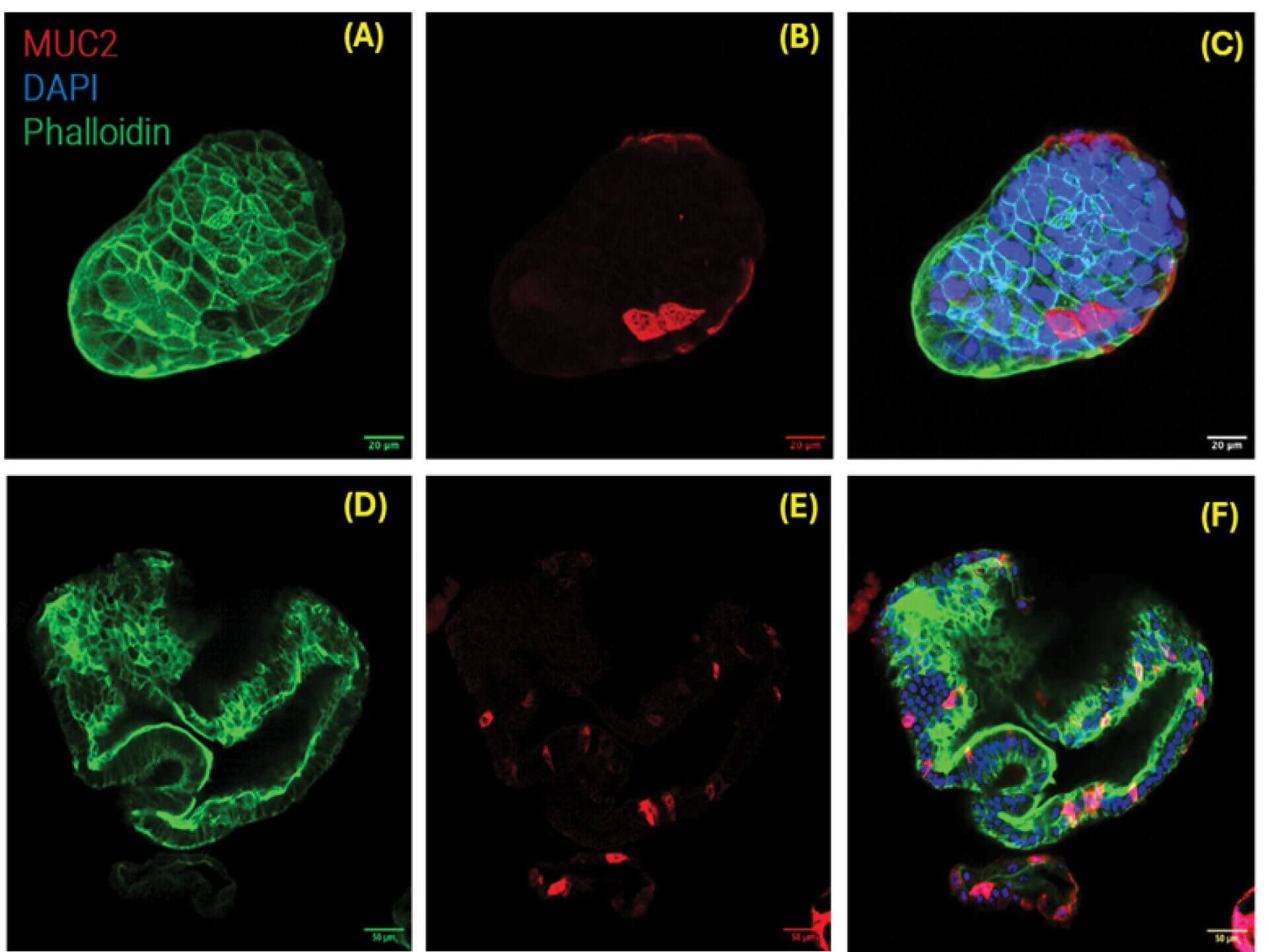 Panel A: green fluorescent actin/cytoskeleton structure in a cell on a black background (scale bar 20 μm). Text labels MUC2 (red), DAPI (blue), Phalloidin (green) visible nearby in the image area, but the main subject is the green network.