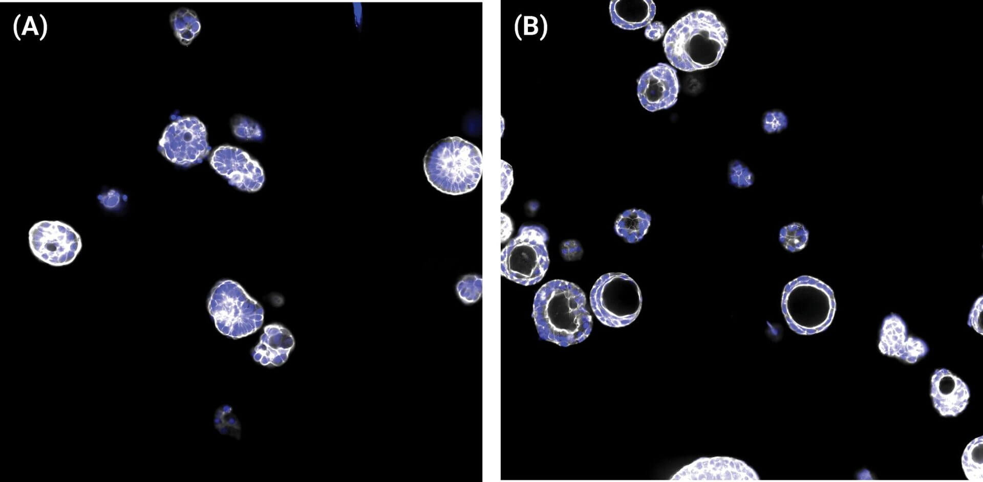 Two side-by-side micrographs of blue-stained circular cells in a dark field, labeled (A) and (B); (A) scattered cells, (B) more clustered toward the right side.
