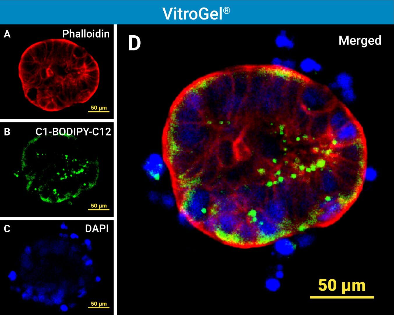 Composite fluorescence image of a cell in VitroGel showing red actin (phalloidin), green lipid marker (C1-BODIPY-C12), and blue nuclei (DAPI) with a 50 μm scale bar; merged panel on the right.