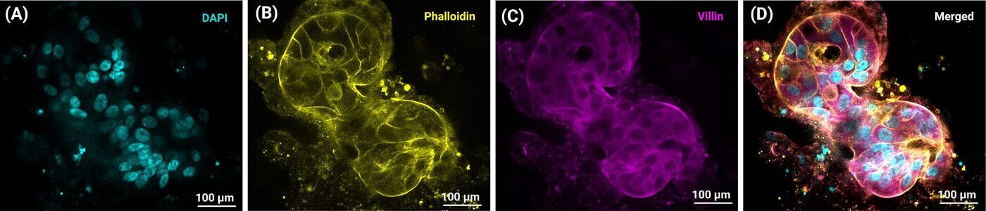 DAPI staining highlights nuclei in cyan within a cell cluster (panel A).","Phalloidin labeling shows actin-rich structures in yellow (panel B).","Villin staining reveals magenta microvilli-rich cytoplasm (panel C).","Merged multicolor image combines DAPI, Phalloidin, and Villin signals (panel D).