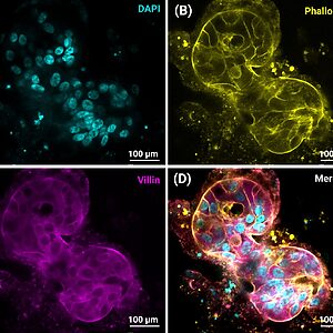 Panel (A): DAPI-stained cell nuclei appear cyan, clustered in a dark field. Scale bar 100 μm.