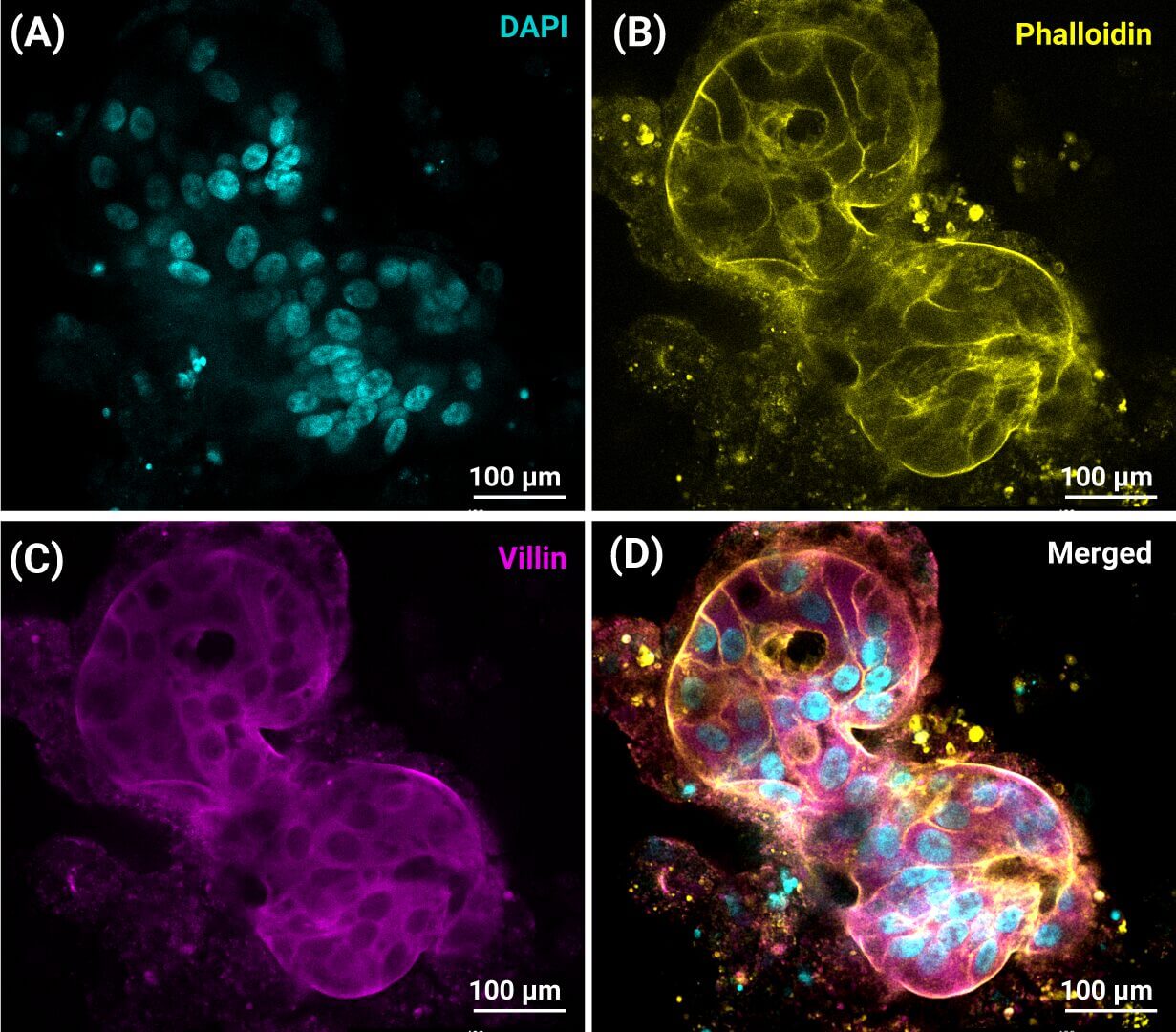 Panel (A): DAPI-stained cell nuclei appear cyan, clustered in a dark field. Scale bar 100 μm.