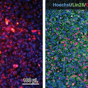 Two-panel fluorescence image of cells: left panel shows blue nuclei (Hoechst) with red SSEA1/SSEA4 signal; right panel shows blue nuclei with green Lin28 and red Oct4 signals, scale bar 100 μm.