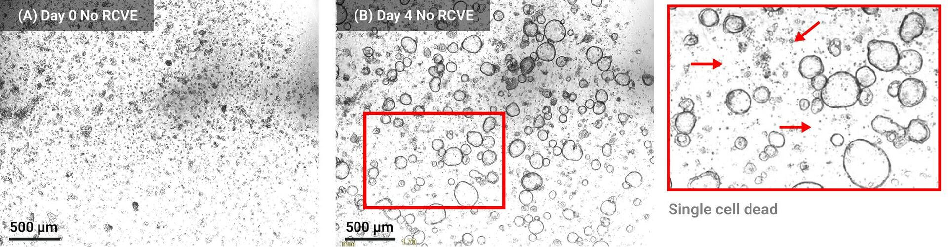 Microscope images show cell suspension over 0 and 4 days without RCVE; insets highlight dead cells with arrows.