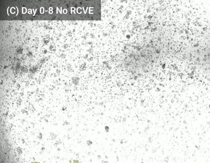 Grayscale microscopic field with dense speckled texture and several darker circular spots; watermark reads Day 0-8 No RCVE.