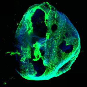 Fluorescent micrograph of a round cell with green membrane/cytoskeleton staining and blue nuclei.