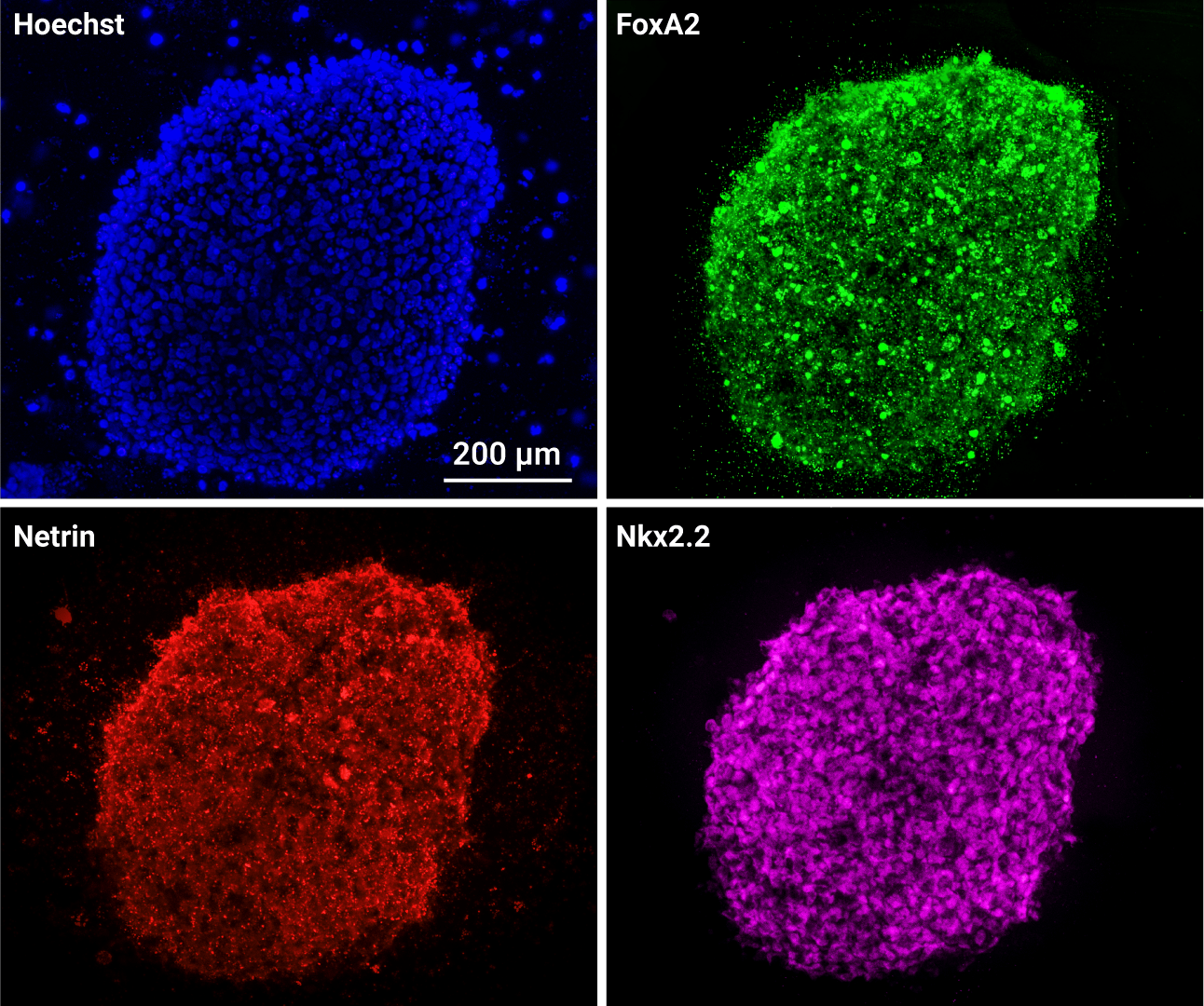 Blue nuclei stained with Hoechst in a dense cell cluster; scale bar shows 200 µm; dark background.
