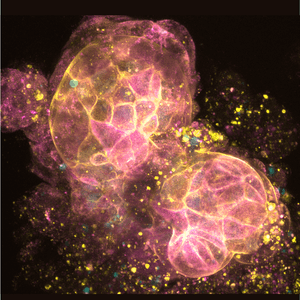 Fluorescent micrograph of a tissue sample with magenta and yellow staining highlighting cellular structures against a dark background.