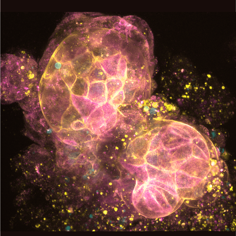 Fluorescent micrograph of a tissue sample with magenta and yellow staining highlighting cellular structures against a dark background.