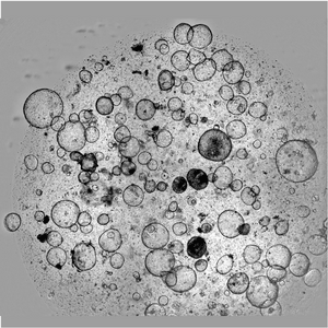 Electron microscopy image showing a cell interior with many circular vesicles of various sizes scattered throughout the cytoplasm