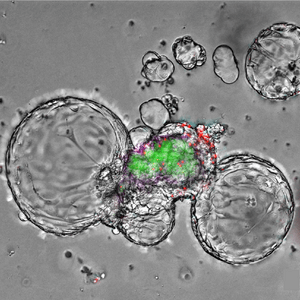 Gray, close-up image of round cell-like structures with dark outlines and faint interiors; color specks appear near the bottom.