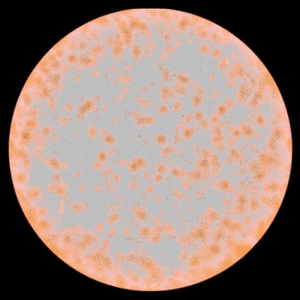Microscopic view of a circular field showing many orange-stained colonies scattered on a pale grey background, likely bacterial colonies on a slide or culture plate.