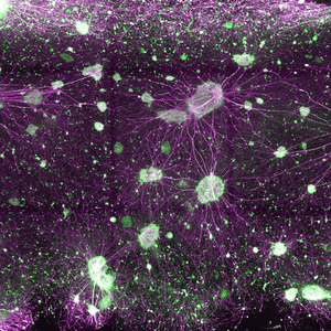 Fluorescent micrograph of a neural network: green cell bodies with magenta-colored neurites extending between them.
