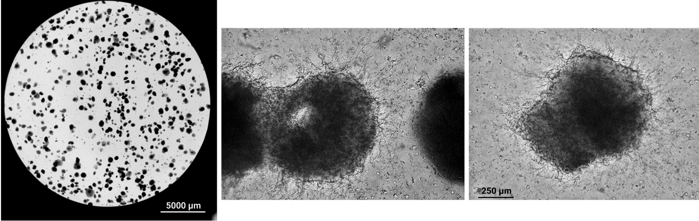Three-panel microscopy image: left shows a circular field densely populated with small dark particles; center and right show two large dark clusters with a fibrous halo.