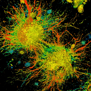 Abstract paint-splatter art: two bright yellow clusters with red, orange, green spokes radiating on a black background.
