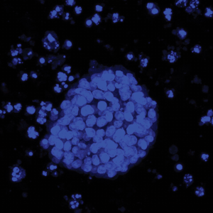 Fluorescent blue microscopy image showing a cluster of round cells forming a dense colony, with scattered smaller cell groups nearby.
