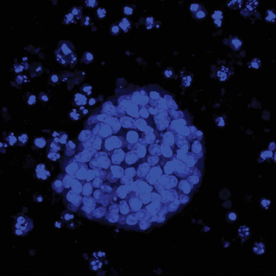 Fluorescent blue microscopy image showing a cluster of round cells forming a dense colony, with scattered smaller cell groups nearby.