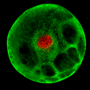 Fluorescent image of a single cell: green cytoplasm with a dense red-stained nucleus at the center, on a black background.