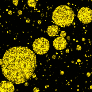 Microscopic view of yellow spherical droplets varying in size scattered on a black background.