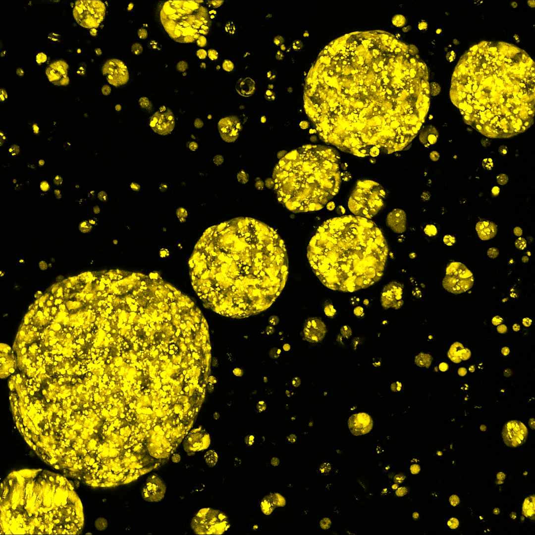 Microscopic view of yellow spherical droplets varying in size scattered on a black background.