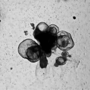Cluster of rounded dark cells near the bottom center-right against a speckled gray background, seen under a microscope.